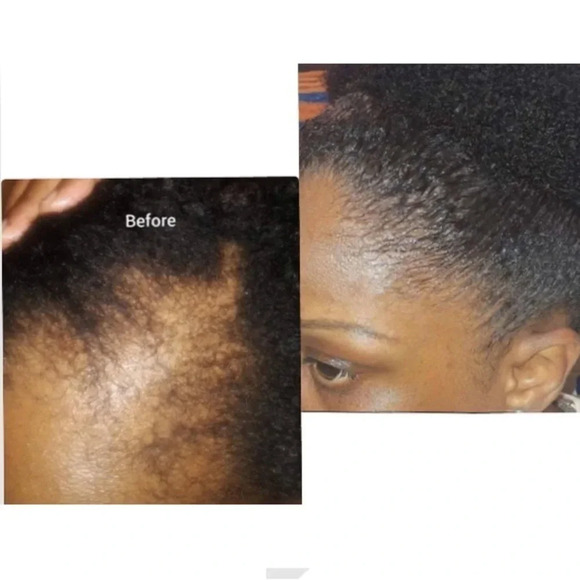 COPY - Hair growth oil, help with alopecia, hair loss, chebe & fenugreek. Organ… - Picture 7 of 7